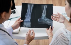 foot x ray image