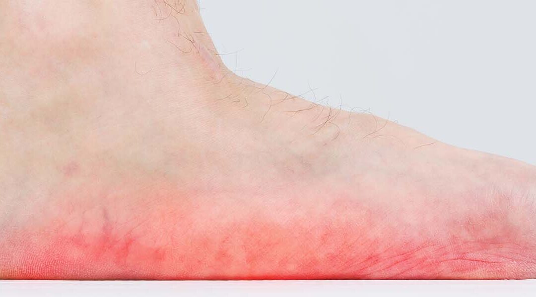 The Best Walking Trails in Bradenton for People with Flat Feet