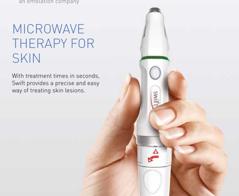 Banish Stubborn Warts with SWIFT Microwave Therapy